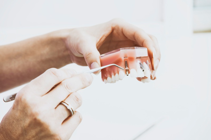 Why Should a Family Dentist Be Your First Choice for Dental Care?