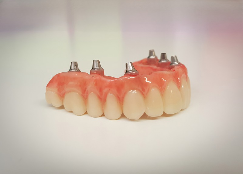 What Are The Biocompatibility Advantages Of Zirconia Tooth Implants?